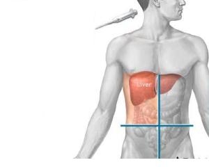 Hepatitele acute virale